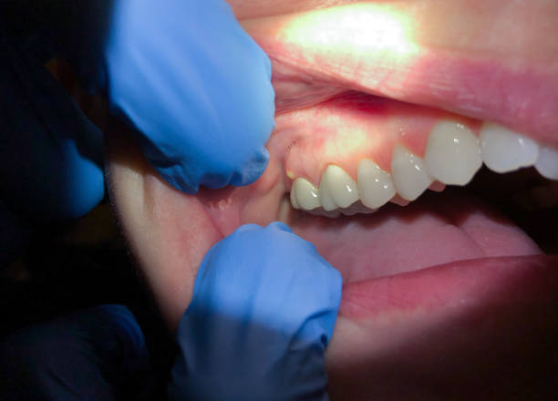 Best Broken Tooth Emergency  in Hillsboro, OH