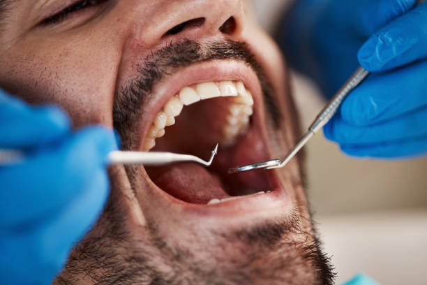 Best Emergency Dental Services Near Me  in Hillsboro, OH