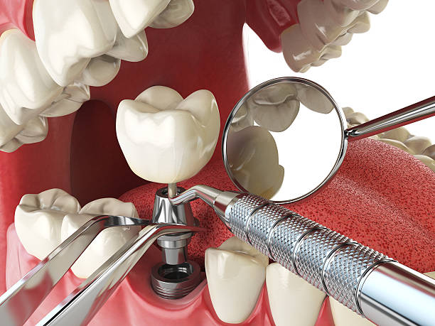 Best Knocked-Out Tooth Emergency  in Hillsboro, OH